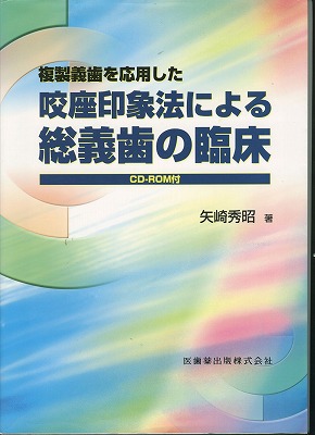 複製義歯を応用した咬座印象法による総義歯の臨床