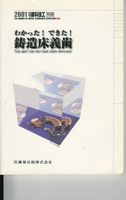 わかった!できた!鋳造床義歯
