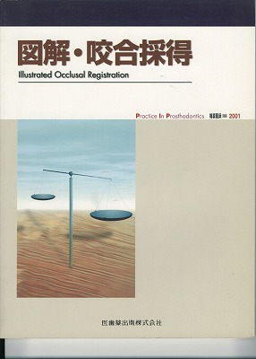 図解・咬合採得