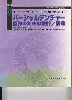 パーシャルデンチャー製作のための設計／構造
