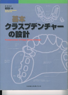 基本　クラスプデンチャーの設計