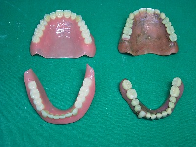 BPS義歯