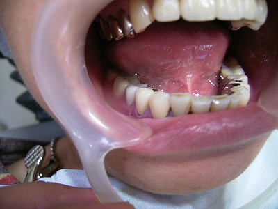 OPA