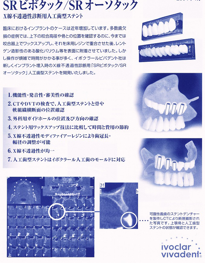 人工歯型ステント