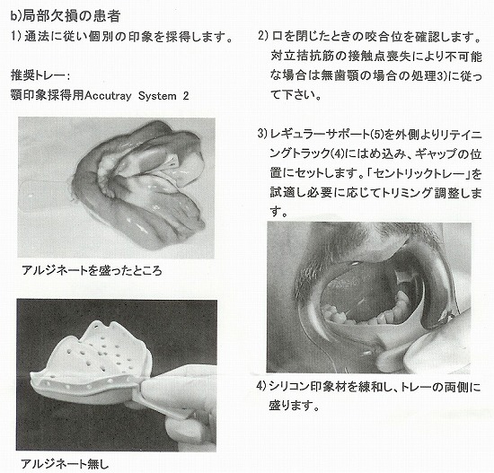 セントリックトレー