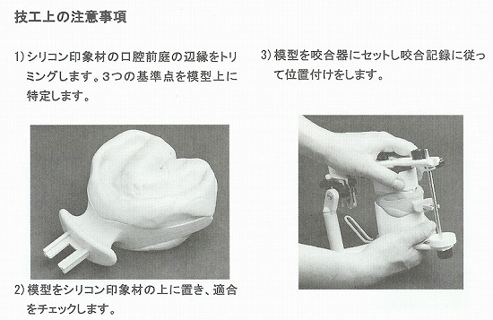 セントリックトレー