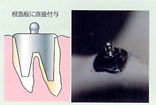 クーゲルホック　メール